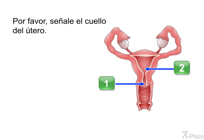 Por favor, seale el cuello del tero.