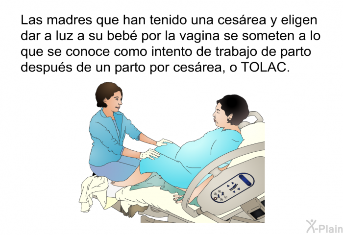 Las madres que han tenido una cesrea y eligen dar a luz a su beb por la vagina se someten a lo que se conoce como intento de trabajo de parto despus de un parto por cesrea, o TOLAC.