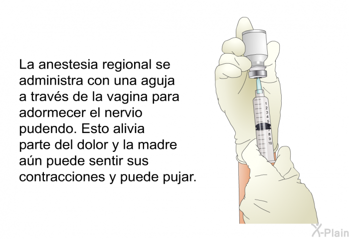 La anestesia regional se administra con una aguja a travs de la vagina para adormecer el nervio pudendo. Esto alivia parte del dolor y la madre an puede sentir sus contracciones y puede pujar.