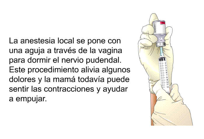 La anestesia local se pone con una aguja a travs de la vagina para dormir el nervio pudendal. Este procedimiento alivia algunos dolores y la mam todava puede sentir las contracciones y ayudar a empujar.