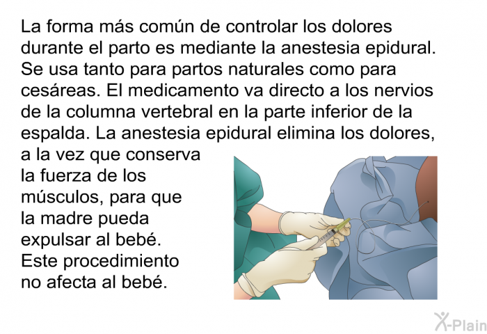 La forma ms comn de controlar los dolores durante el parto es mediante la anestesia epidural. Se usa tanto para partos naturales como para cesreas. El medicamento va directo a los nervios de la columna vertebral en la parte inferior de la espalda. La anestesia epidural elimina los dolores, a la vez que conserva la fuerza de los msculos, para que la madre pueda expulsar al beb. Este procedimiento no afecta al beb.