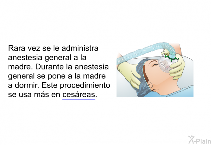 Rara vez se le administra anestesia general a la madre. Durante la anestesia general se pone a la madre a dormir. Este procedimiento se usa ms en cesreas.