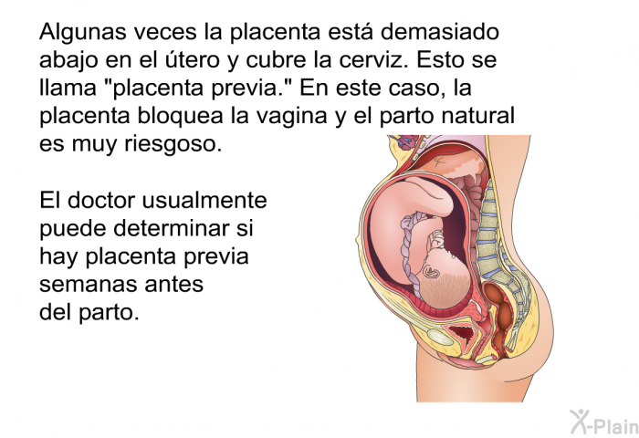 Algunas veces la placenta est� demasiado abajo en el �tero y cubre la cerviz. Esto se llama &ldquo;placenta previa.&rdquo; En este caso, la placenta bloquea la vagina y el parto natural es muy riesgoso. El doctor usualmente puede determinar si hay placenta previa semanas antes del parto.