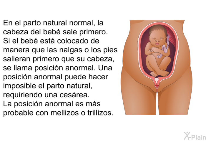 En el parto natural normal, la cabeza del beb� sale primero. Si el beb� est� colocado de manera que las nalgas o los pies salieran primero que su cabeza, se llama posici�n anormal. Una posici�n anormal puede hacer imposible el parto natural, requiriendo una ces�rea. La posici�n anormal es m�s probable con mellizos o trillizos.