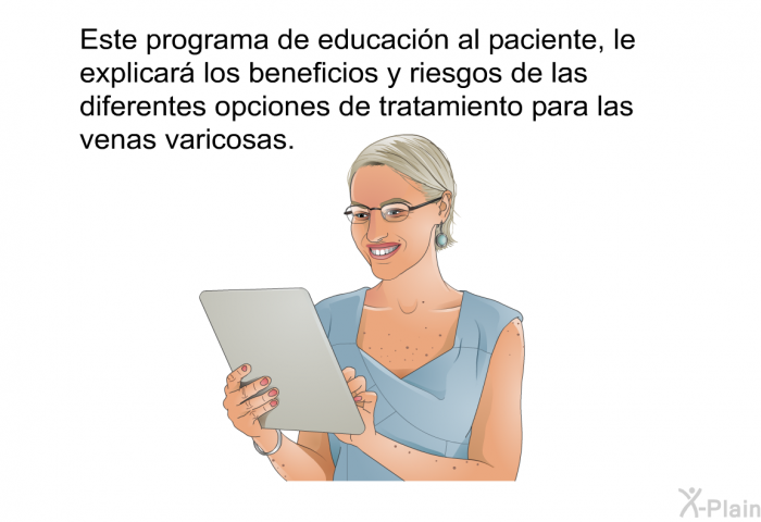 Esta informacin acerca de su salud, le explicar los beneficios y riesgos de las diferentes opciones de tratamiento para las venas varicosas.