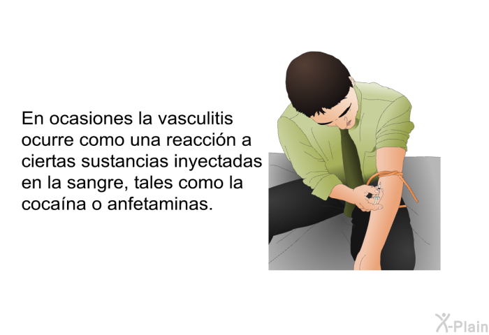En ocasiones la vasculitis ocurre como una reaccin a ciertas sustancias inyectadas en la sangre, tales como la cocana o anfetaminas.