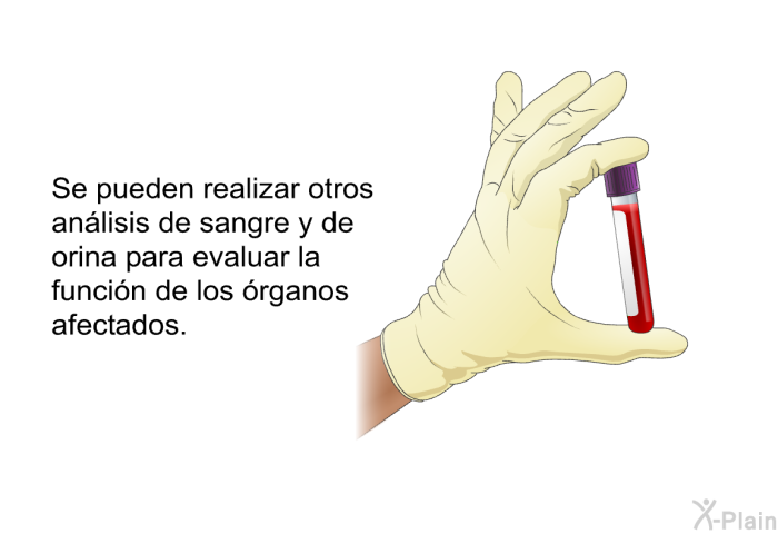 Se pueden realizar otros anlisis de sangre y de orina para evaluar la funcin de los rganos afectados.