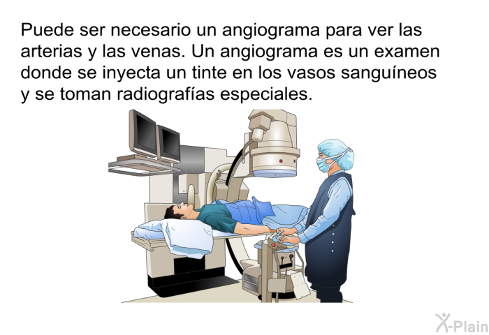 Puede ser necesario un angiograma para ver las arterias y las venas. Un angiograma es un examen donde se inyecta un tinte en los vasos sanguneos y se toman radiografas especiales.