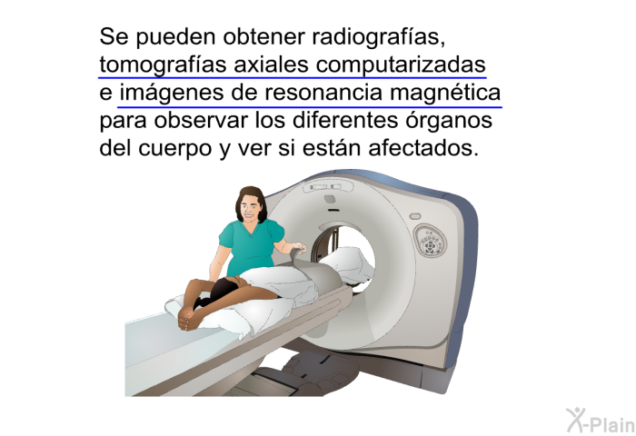 Se pueden obtener radiografas, tomografas axiales computarizadas e imgenes de resonancia magntica para observar los diferentes rganos del cuerpo y ver si estn afectados.