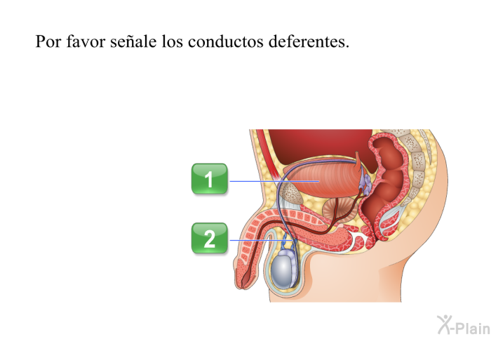 Por favor seale los conductos deferentes.