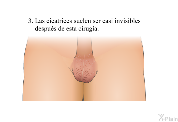 Las cicatrices suelen ser casi invisibles despus de esta ciruga.