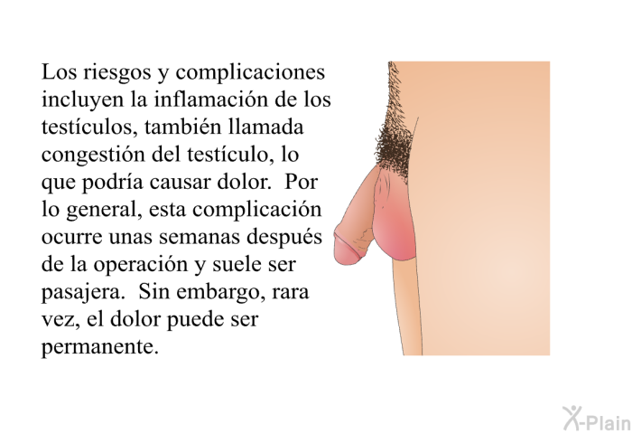 Los riesgos y complicaciones incluyen la inflamacin de los testculos, tambin llamada <I>congestin </I>del testculo, lo que podra causar dolor. Por lo general, esta complicacin ocurre unas semanas despus de la operacin y suele ser pasajera. Sin embargo, rara vez, el dolor puede ser permanente.