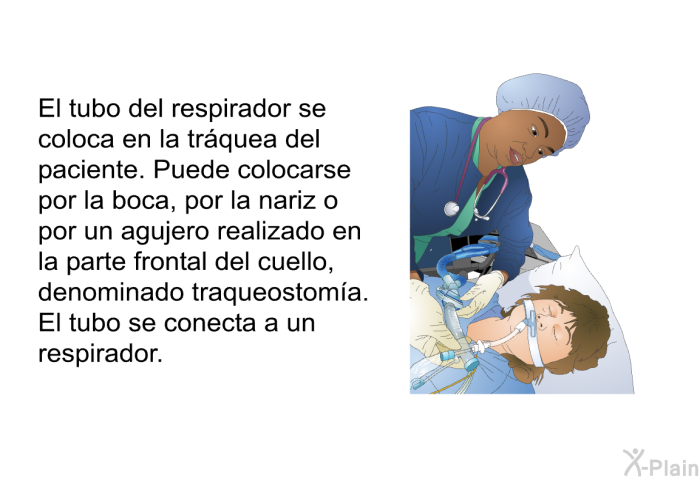 El tubo del respirador se coloca en la trquea del paciente. Puede colocarse por la boca, por la nariz o por un agujero realizado en la parte frontal del cuello, denominado traqueostoma. El tubo se conecta a un respirador.