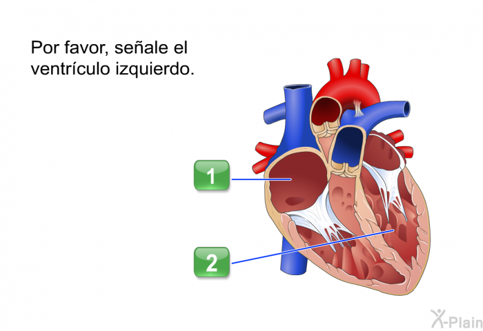 Por favor, seale el ventrculo izquierdo.
