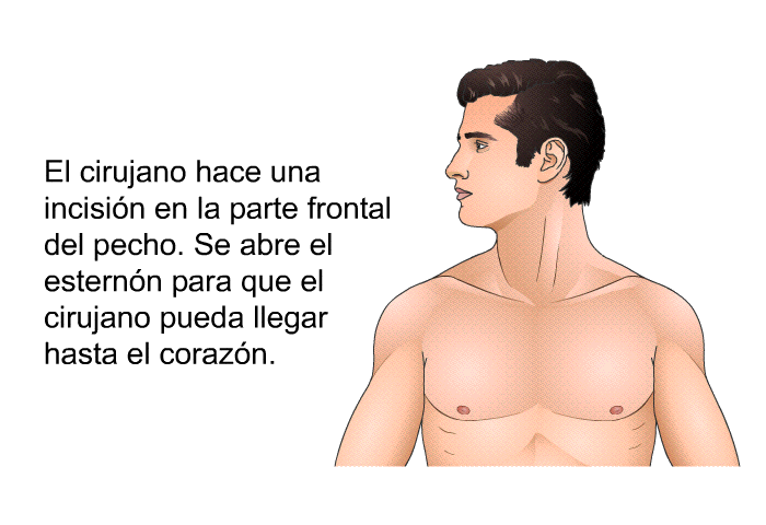 El cirujano hace una incisi�n en la parte frontal del pecho.&nbsp;Se abre el estern�n para que el cirujano pueda llegar hasta el coraz�n.