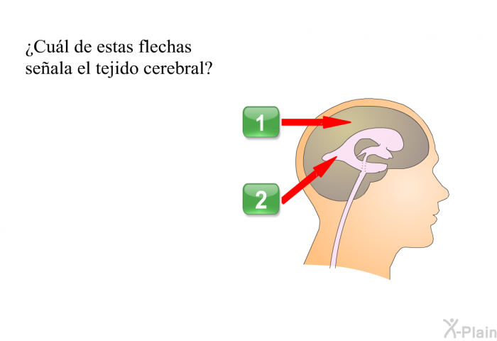 ¿Cul de estas flechas seala el tejido cerebral?