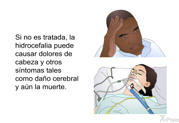 Si no es tratada, la hidrocefalia puede causar dolores de cabeza y otros sntomas tales como dao cerebral y an la muerte.