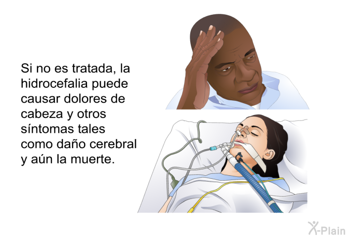 Si no es tratada, la hidrocefalia puede causar dolores de cabeza y otros sntomas tales como dao cerebral y an la muerte.