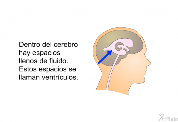 Dentro del cerebro hay espacios llenos de fluido. Estos espacios se llaman ventrculos.