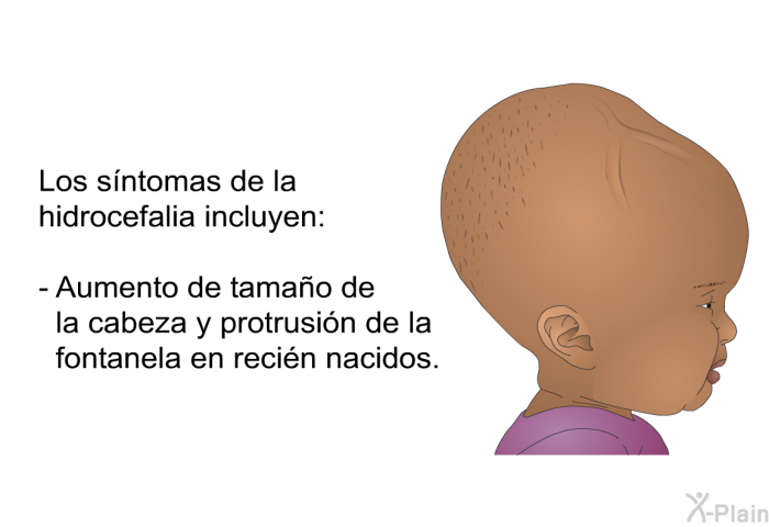 Los sntomas de la hidrocefalia incluyen: 

  Aumento de tamao de la cabeza y protrusin de la fontanela en recin nacidos.