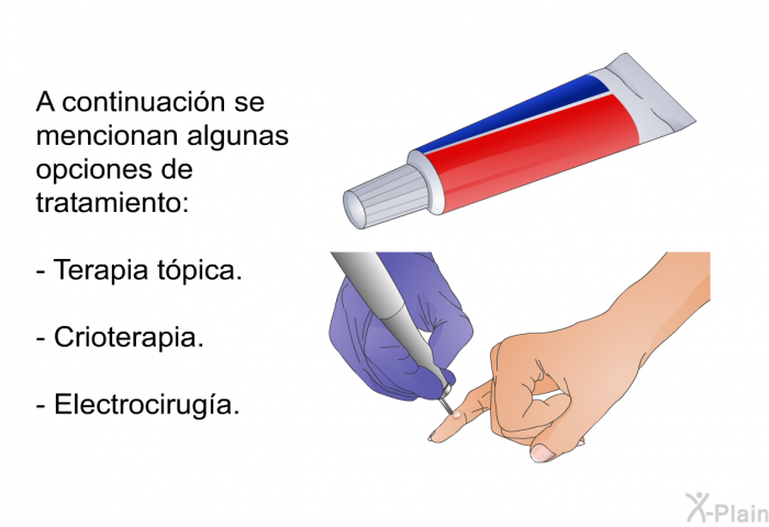 A continuacin se mencionan algunas opciones de tratamiento:  Terapia tpica. Crioterapia. Electrociruga.