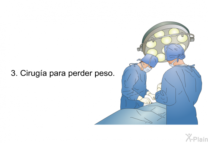 Cirug�a para perder peso.