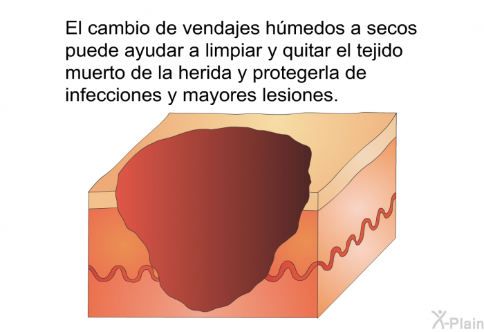 El cambio de vendajes hmedos a secos puede ayudar a limpiar y quitar el tejido muerto de la herida y protegerla de infecciones y mayores lesiones.