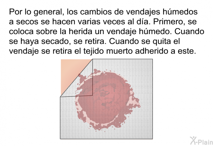 Por lo general, los cambios de vendajes hmedos a secos se hacen varias veces al da. Primero, se coloca sobre la herida un vendaje hmedo. Cuando se haya secado, se retira. Cuando se quita el vendaje se retira el tejido muerto adherido a este.