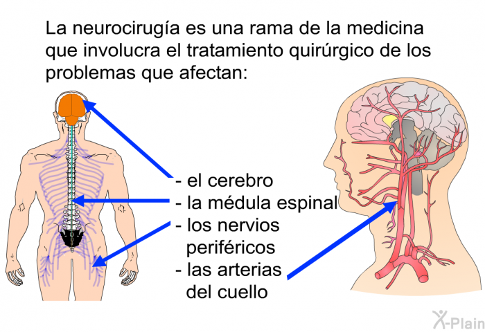 La neurociruga es una rama de la medicina que involucra el tratamiento quirrgico de los problemas que afectan  el cerebro la mdula espinal los nervios perifricos las arterias del cuello